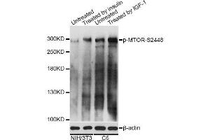 Western blot analysis of extracts of NIH/3T3 and C6 cells, using Phospho-MTOR-S2448 antibody. (MTOR Antikörper  (pSer2448))