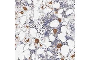 Immunohistochemical staining of human bone marrow with ZRANB1 polyclonal antibody  shows distinct cytoplasmic positivity in bone marrow poietic cells at 1:50-1:200 dilution. (ZRANB1 Antikörper)