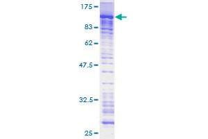 Image no. 1 for PML-RARA Regulated Adaptor Molecule 1 (PRAM1) (AA 1-670) protein (GST tag) (ABIN1316121) (PRAM1 Protein (AA 1-670) (GST tag))