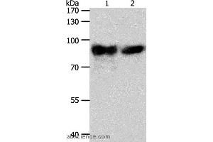 Western blot analysis of Mouse heart tissue and hela cell, using ACO2 Polyclonal Antibody at dilution of 1:400 (ACO2 Antikörper)