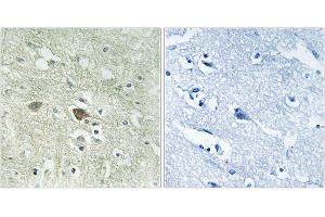 Immunohistochemistry analysis of paraffin-embedded human brain tissue using NDUFV3 antibody. (NDUFV3 Antikörper)