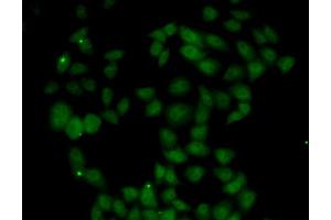 Immunofluorescence analysis of U20S cell using FGF14 antibody. (FGF14 Antikörper)