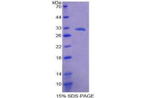 SDS-PAGE (SDS) image for Arachidonate 15-Lipoxygenase B (ALOX15B) (AA 253-490) protein (His tag) (ABIN2124059)