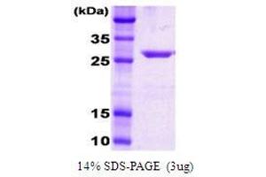 Figure annotation denotes ug of protein loaded and % gel used. (DnaK (AA 385-638), (C-Term) Peptid)