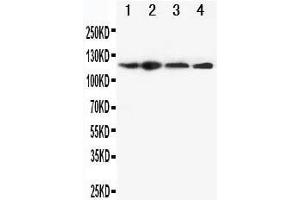 Anti-CIAS1/NALP3 antibody, Western blotting Lane 1: HEP-2 Cell Lysate Lane 2: A549 Cell Lysate Lane 3: U87 Cell Lysate Lane 4: CEM Cell Lysate (NLRP3 Antikörper  (N-Term))