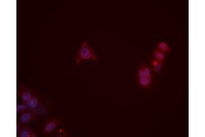 Immunofluorescence (fixed cells) (IF/ICC) image for anti-Opioid Receptor, mu 1 (OPRM1) (C-Term) antibody (ABIN6257397)