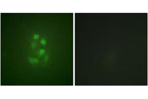 Immunofluorescence analysis of A549 cells, using KIF2C (Phospho-Ser95) Antibody. (KIF2C Antikörper  (pSer95))