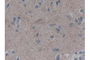Immunohistochemistry (IHC) image for anti-Fibroblast Growth Factor 12 (FGF12) (AA 1-181) antibody (ABIN7435244)