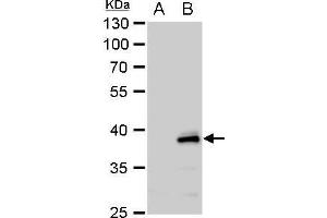 WB Image YKL-39 antibody [N1C3] detects YKL-39 protein by western blot analysis. (CHI3L2 Antikörper)