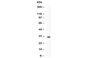 Western blot testing of recombinant mouse IL17 protein (0. (IL-17 Antikörper  (AA 26-158))