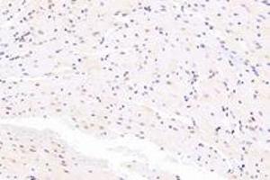 Immunohistochemistry (Paraffin-embedded Sections) (IHC (p)) image for anti-serum Response Factor Binding Protein 1 (SRFBP1) antibody (ABIN7075579)