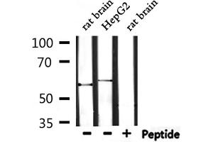 Western blot analysis of extracts from rat brain and HepG2, using TRIO Antibody. (TRIO Antikörper  (Internal Region))