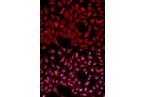 Immunofluorescence (IF) image for anti-E3 Ubiquitin-Protein Ligase SIAH1 (SIAH1) antibody (ABIN1874778) (SIAH1 Antikörper)
