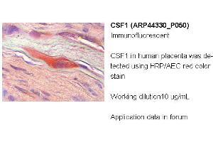 Image no. 2 for anti-Colony Stimulating Factor 1 (Macrophage) (CSF1) (Middle Region) antibody (ABIN502500) (M-CSF/CSF1 Antikörper  (Middle Region))