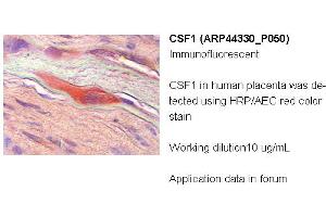 Image no. 2 for anti-Colony Stimulating Factor 1 (Macrophage) (CSF1) (Middle Region) antibody (ABIN2781823) (M-CSF/CSF1 Antikörper  (Middle Region))