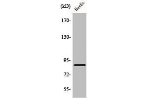 Western Blotting (WB) image for anti-Protein Kinase, CGMP-Dependent, Type II (PRKG2) (Internal Region) antibody (ABIN7186319)