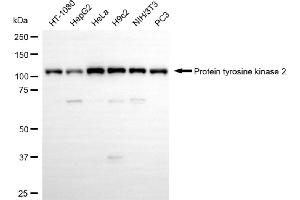 Western blotting analysis using protein tyrosine kinase 2 antibody (ABIN7800062).