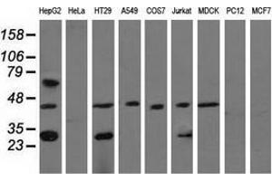 Western blot analysis of extracts (35 µg) from 9 different cell lines by using anti-QPRT monoclonal antibody. (QPRT Antikörper)
