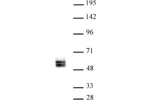 TCF7 antibody (pAb) tested by Western blot. (TCF7 Antikörper  (N-Term))