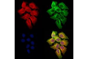 ABIN6258102 and ABIN6273682 staining Hela cells by IF/ICC. (Keratin 36 Antikörper  (Internal Region))