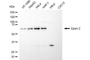 Western blotting analysis using epsin 2 antibody (ABIN7798489). (Epsin 2 Antikörper)
