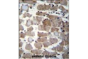 CTSK Antibody (Center ) (ABIN656812 and ABIN2846026) immunohistochemistry analysis in formalin fixed and paraffin embedded human skeletal muscle followed by peroxidase conjugation of the secondary antibody and DAB staining. (Cathepsin K Antikörper  (AA 97-126))