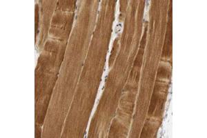 Immunohistochemical staining (Formalin-fixed paraffin-embedded sections) of human skeletal muscle with PDLIM3 polyclonal antibody  shows strong cytoplasmic positivity in myocytes.