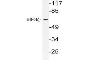 Western blot analysis using eIF3D antibody in extracts from 3T3 cells. (EIF3D Antikörper)