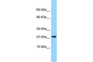 WB Suggested Anti-NDUFAF2 Antibody Titration: 1. (NDUFAF2 Antikörper  (N-Term))