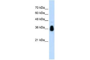 WB Suggested Anti-MKRN1 Antibody Titration:  1. (MKRN1 Antikörper  (C-Term))