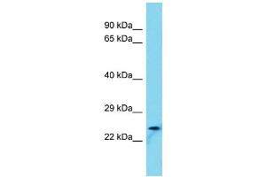 Host: Rabbit Target Name: FAM101B Sample Type: U937 Whole Cell lysates Antibody Dilution: 1. (FAM101B Antikörper  (N-Term))