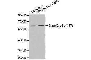 Western blot analysis of extracts of Untreated and treated 293T cell lines, using Phospho-SMAD2-S467 antibody. (SMAD2 Antikörper  (pSer467))