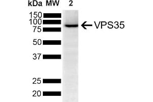 Western Blot analysis of Human SH-SY5Y showing detection of VPS35 protein using Mouse Anti-VPS35 Monoclonal Antibody, Clone 5A9 (ABIN6932942). (VPS35 Antikörper  (APC))