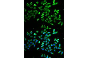 Immunofluorescence (IF) image for anti-Transcription Factor 19 (TCF19) antibody (ABIN1877133) (TCF19 Antikörper)