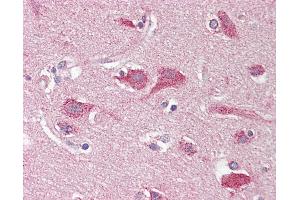 Anti-OPCML / OBCAM antibody IHC staining of human brain, cortex. (OPCML Antikörper)