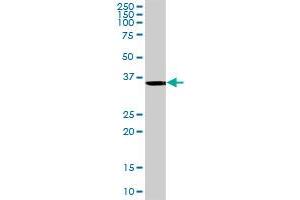 ANKRA2 MaxPab rabbit polyclonal antibody. (ANKRA2 Antikörper  (AA 1-313))