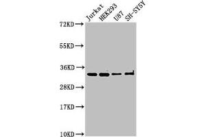 Western Blot Positive WB detected in: Jurkat whole cell lysate, HEK293 whole cell lysate, U87 whole cell lysate, SH-SY5Y whole cell lysate All lanes: CAMLG antibody at 3 μg/mL Secondary Goat polyclonal to rabbit IgG at 1/50000 dilution Predicted band size: 33 kDa Observed band size: 33 kDa (CAMLG Antikörper  (AA 1-189))