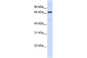 WB Suggested Anti-ACSL5 Antibody Titration:  0.
