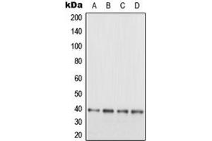 Western blot analysis of EB3 expression in SHSY5Y (A), HeLa (B), SP2/0 (C), PC12 (D) whole cell lysates. (MAPRE3 Antikörper  (C-Term))