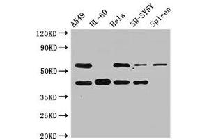 Western Blot Positive WB detected in: A549 whole cell lysate, HL60 whole cell lysate, Hela whole cell lysate, SH-SY5Y whole cell lysate, Rat spleen tissue All lanes: BACE2 antibody at 2. (BACE2 Antikörper  (AA 84-157))