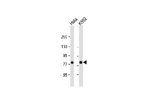 Western Blot at 1:1000 dilution Lane 1: Hela whole cell lysate Lane 2: K562 whole cell lysate Lysates/proteins at 20 ug per lane. (SRP72 Antikörper  (AA 119-148))