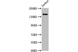 Western Blot Positive WB detected in: Jurkat whole cell lysate All lanes: CARMIL2 antibody at 1:1000 Secondary Goat polyclonal to rabbit IgG at 1/50000 dilution Predicted band size: 155, 149 kDa Observed band size: 155 kDa (RLTPR Antikörper  (AA 1136-1290))
