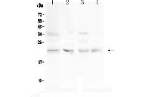 Western blot analysis of TIMP1 using anti-TIMP1 antibody .
