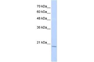 WB Suggested Anti-RBM39 Antibody Titration:  0. (RBM39 Antikörper  (Middle Region))