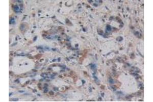 IHC-P analysis of Human Pancreas Tissue, with DAB staining. (Villin 1 Antikörper  (AA 1-320))
