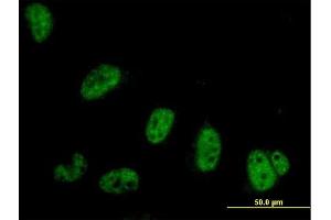 Immunofluorescence of purified MaxPab antibody to SYMPK on HeLa cell. (Symplekin Antikörper  (AA 1-533))