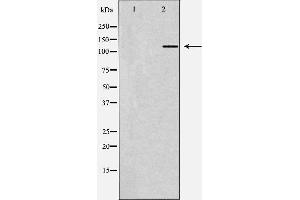 Western blot analysis of Hela whole cell lysates, using ZEB1 Antibody. (ZEB1 Antikörper  (Internal Region))