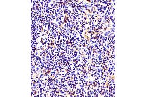 (ABIN6242660 and ABIN6578661) staining beta Tubulin in mouse thymus tissue sections by Immunohistochemistry (IHC-P - paraformaldehyde-fixed, paraffin-embedded sections). (TUBB Antikörper  (AA 46-78))