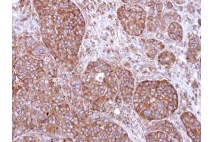 IHC-P Image Immunohistochemical analysis of paraffin-embedded SW480 xenograft, using FBXL2, antibody at 1:500 dilution. (FBXL2 Antikörper  (N-Term))