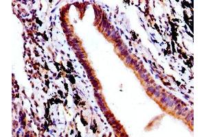 Immunohistochemistry (IHC) image for anti-neonatal Fc Receptor (FcRn) (AA 24-297) antibody (ABIN7156043)